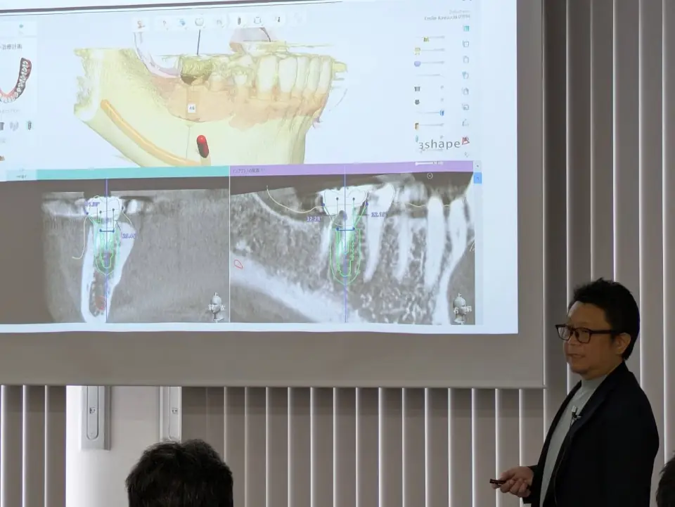 3Shapeのインプラントシミュレーションソフトを用いた院長の講演の様子