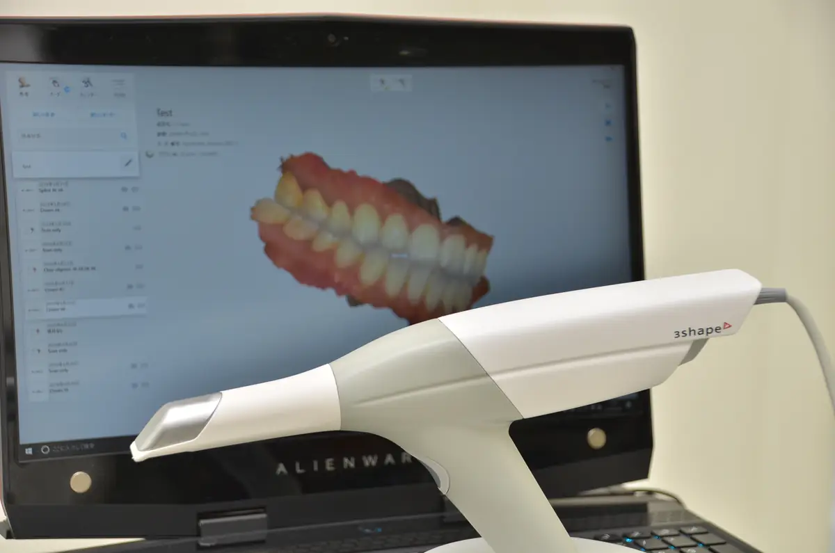 3Shapeの口腔内スキャナーと、歯列の3Dモデルを表示したモニター